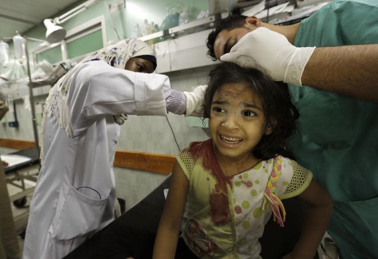 A wounded Palestinian girl who was sheltering in a UN school receives treatment at the Kamal Edwan hospital in Beit Lahia, the northern Gaza Strip, early on July 31, 2014