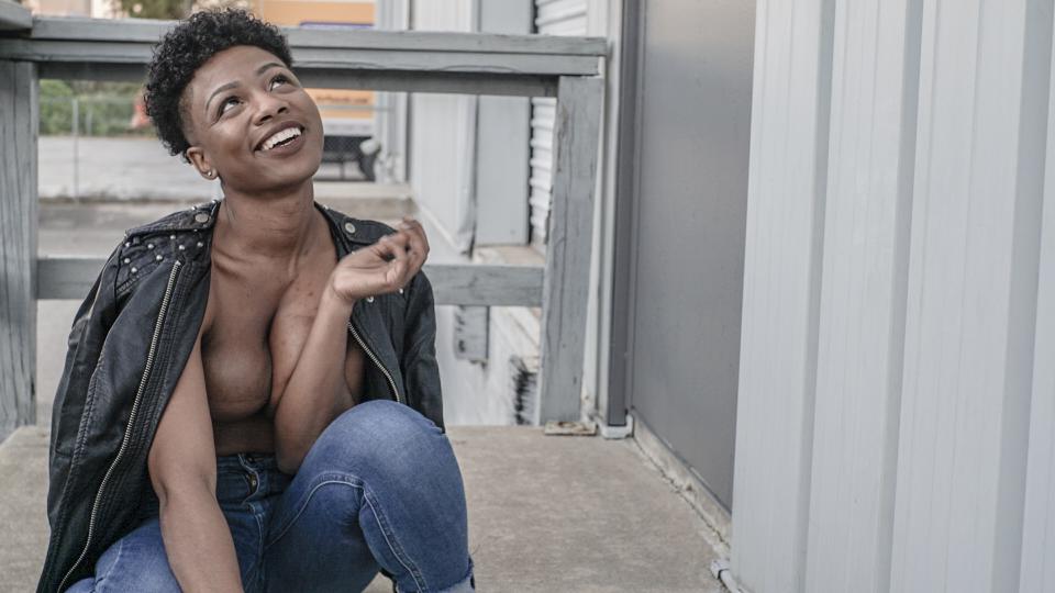 Florence wanted the photo shoot to display her mastectomy scars. (Photo:<a href="https://www.instagram.com/nemosnaps/" rel="nofollow noopener" target="_blank" data-ylk="slk:Nehemiah Nash;elm:context_link;itc:0;sec:content-canvas" class="link "> Nehemiah Nash</a>)