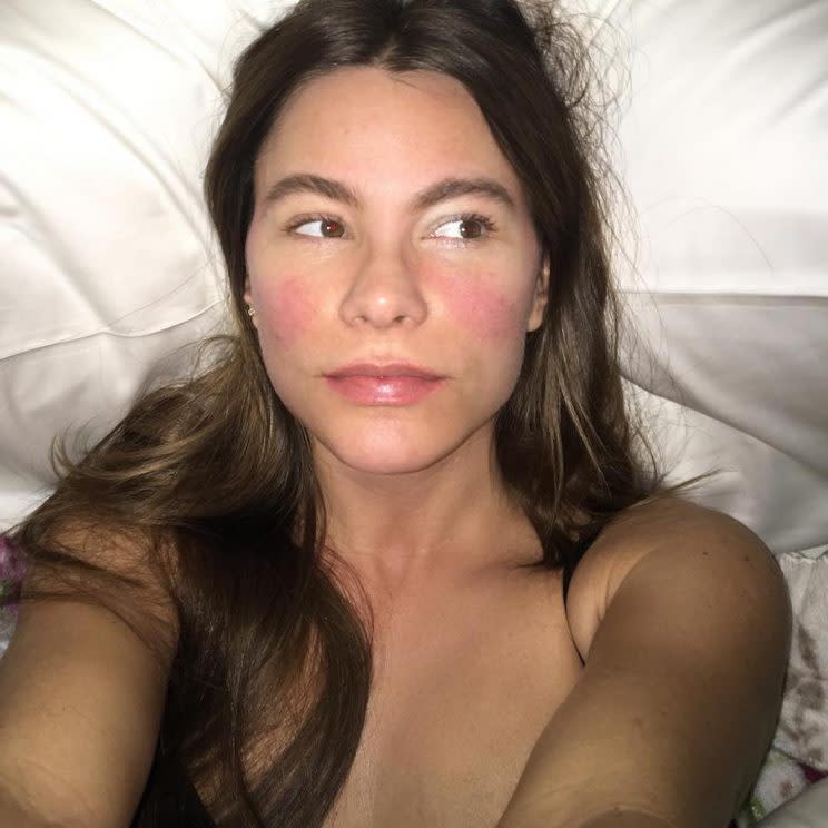 Of course, Sofia Vergara would look cute while sick in bed with a 102 degree fever. (Photo: Sofia Vergara via Instagram)