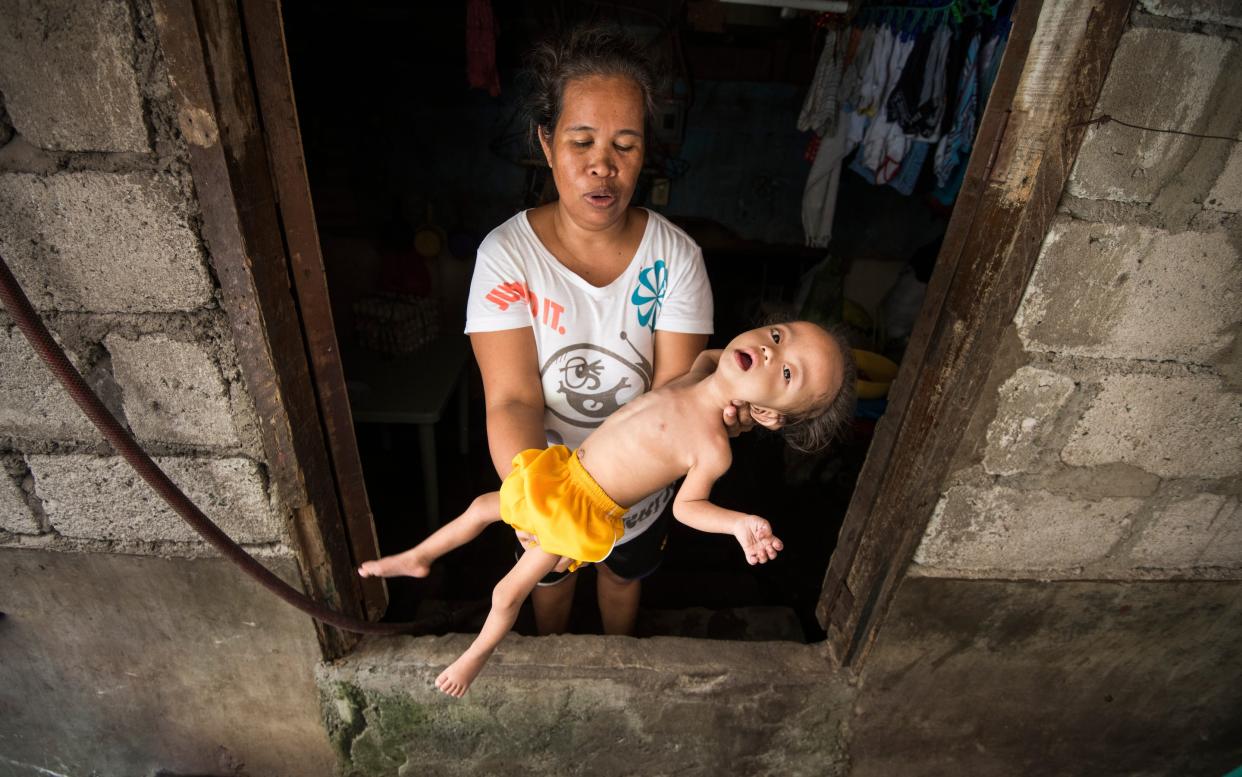 A mother holding her malnourished child in Navotas City, Philippines - Simon Townsley/The Telegraph