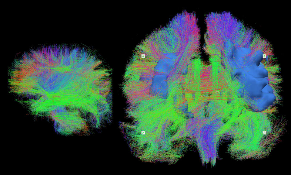 This is a detailed map of the brain wiring in a sleeping newborn baby (left) and an adult in their seventies (right), visualized using MRI. 