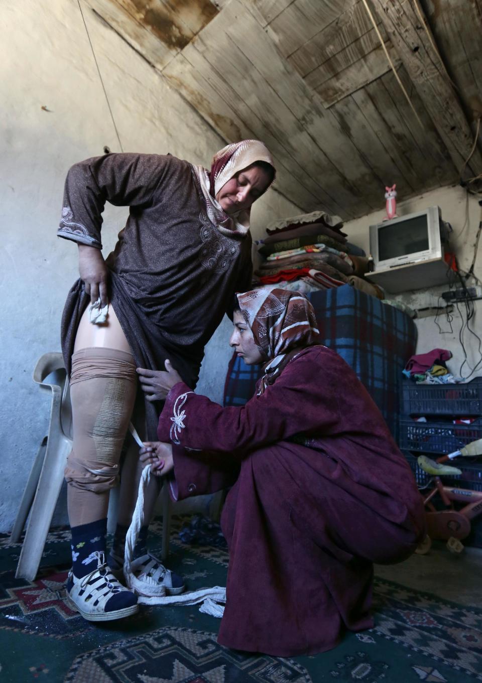 In this Thursday, March 27, 2014 photo, Reem Diab, 34, who lost her leg on Oct. 25, 2012 when a shell slammed into her house in the town of Khan Sheikoun in central Syria, takes off her artificial leg with the help of her relative, right, in Chtaoura, in the Bekaa valley, Lebanon. The shelling killed her husband, Mustafa, and her 15-year-old daughter, Batoul. Syria’s civil war, which entered its fourth year last month, has killed more than 150,000 people. An often overlooked figure is the number of wounded more than 500,000, according to the International Committee of the Red Cross. An untold number of those, there’s no reliable estimate even, have suffered traumatic injuries that have left them physically handicapped. (AP Photo/Bilal Hussein)