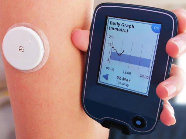 Continuous glucose monitors or CGM with sensor and mobile phone displaying graph of levels.