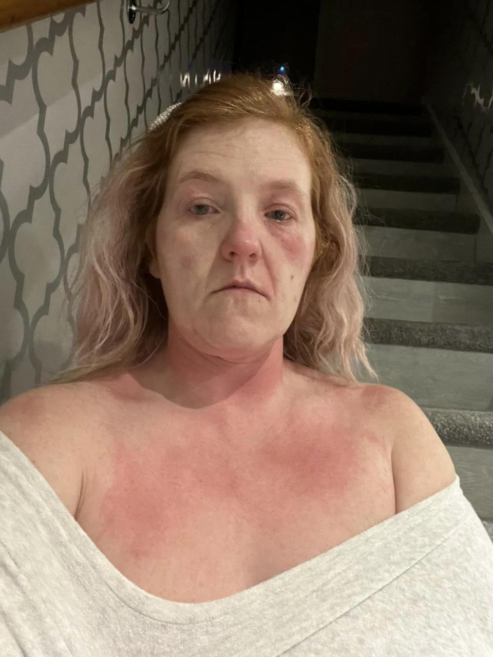 Jonathan Neale's wife Claire, pictured after he strangled her when she found his text messages to other women. (Wales News Service)