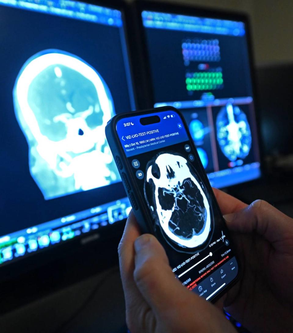 Dr. Andrew Griffin II, MD, a neuro-interventional radiologist at Novant Health Presbyterian Medical Center in Charlotte used VIZ.AI, an artificial intelligence app on his cell phone to analyze a patient's brain.  