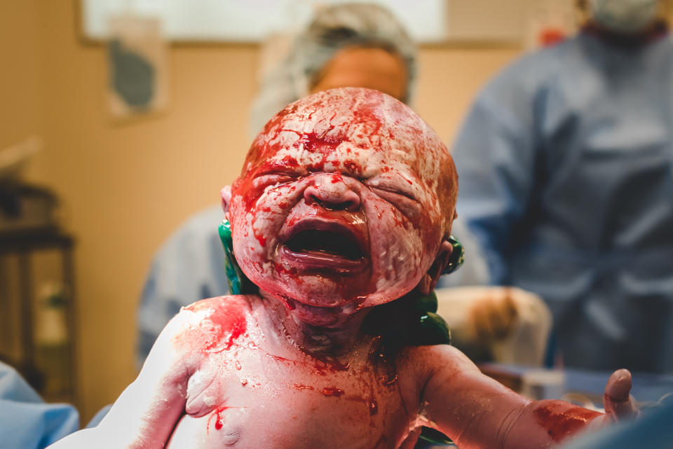 "This image may be too much for some, but it is real life! It is messy &mdash; and so is all birth, belly or vaginal." 