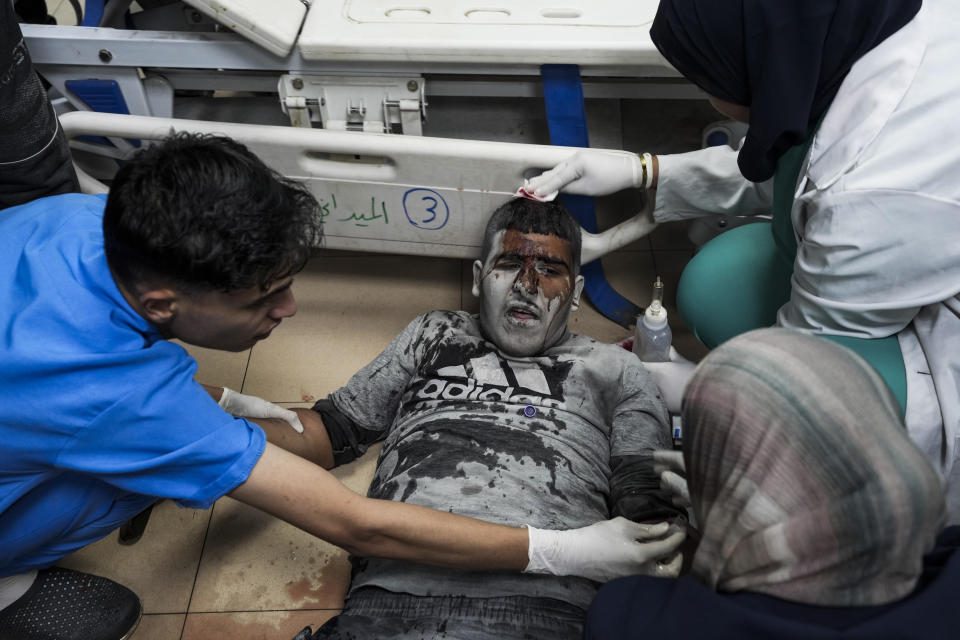 A Palestinian wounded in the Israeli bombardment of the Gaza Strip is treated in a hospital in Deir al Ballah on Wednesday, June 5, 2024. (AP Photo/Abdel Kareem Hana)