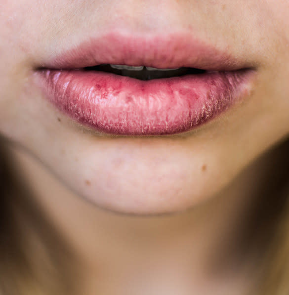 A closeup of a person's slightly chapped lips