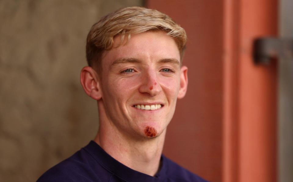 Anthony Gordon at England's training base in Blankenhain after falling off his bike