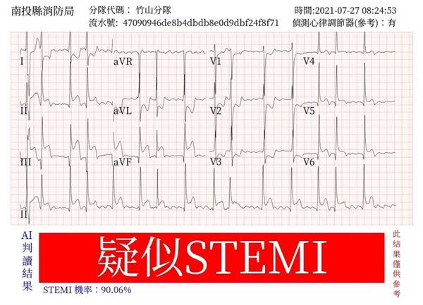 消防局救護人員現場執行心電圖後AI即時回傳判讀結果。（圖片提供／中醫大附醫）