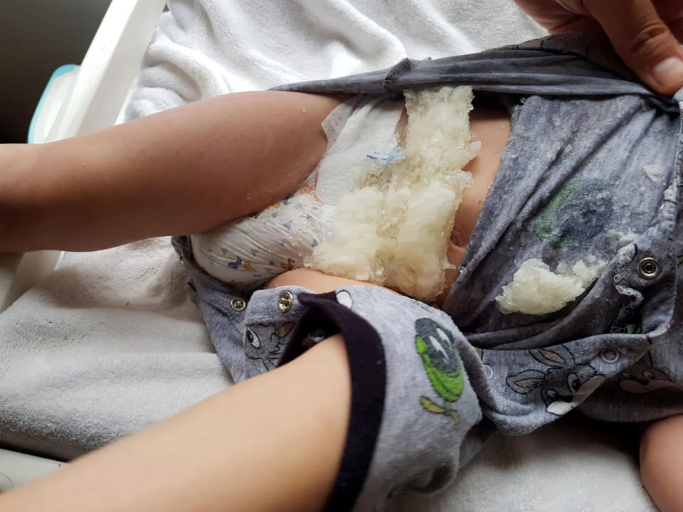 A dad was horrified to discover his son’s nappy had exploded overnight [Photo: Caters]