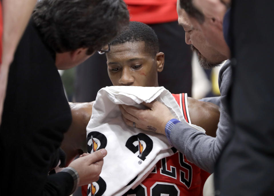 Chicago Bulls’ Kris Dunn is treated by the medical staff after hitting his face on the floor after a dunk against the Golden State Warriors Wednesday, Jan. 17, 2018, in Chicago. (AP)