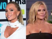 To celebrate her 10th season on the <i>Real Housewives of Orange County</i>, the 49-year-old TV star revealed that she got a lower facelift and eye tuck — and showed off the results just two weeks after undergoing surgery <a href="http://people.com/style/tamra-judge-facelift-watch-what-happens-live/" rel="nofollow noopener" target="_blank" data-ylk="slk:on;elm:context_link;itc:0;sec:content-canvas" class="link ">on </a><i><a href="http://people.com/style/tamra-judge-facelift-watch-what-happens-live/" rel="nofollow noopener" target="_blank" data-ylk="slk:Watch What Happens Live;elm:context_link;itc:0;sec:content-canvas" class="link ">Watch What Happens Live</a>.</i> She wrote on <a href="https://www.instagram.com/p/BWa_kz3FYm3/" rel="nofollow noopener" target="_blank" data-ylk="slk:Instagram;elm:context_link;itc:0;sec:content-canvas" class="link ">Instagram</a> that she got an "overwhelming amount of messages" after the news broke and decided to share photos of the healing process. "I'm open and honest about it because I want women to know that everyone gets old even people on TV and there is nothing wrong with growing old gracefully if that's what you want...... It's jut not for me! 😂. I like to keep it real!" She's keeping it so real, she even provided her email address for women to reach out to her directly with questions. 