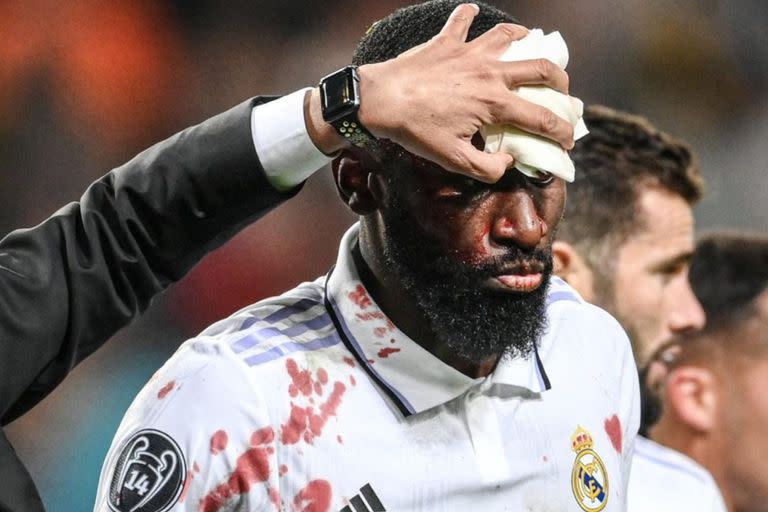 Antonio Rüdiger sufrió un fuerte golpe en el final del partido entre el Real Madrid y el Shakhtar por Champions League