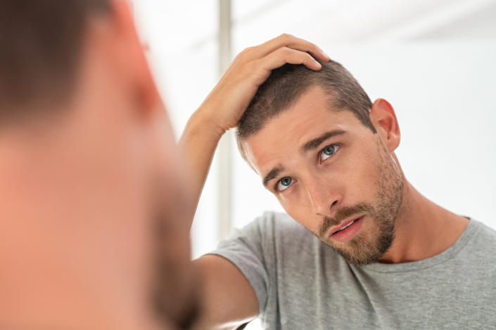 Stock picture of a man inspecting his hairline in the mirror. (Getty Images)