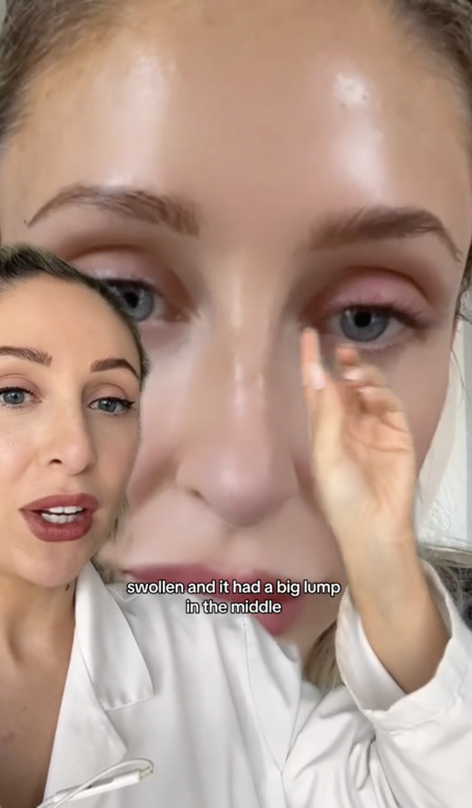 Carly Musleh posted a follow-up video where she showed the reaction she developed after using UKLash (Credit: @carlymusleh / TikTok )