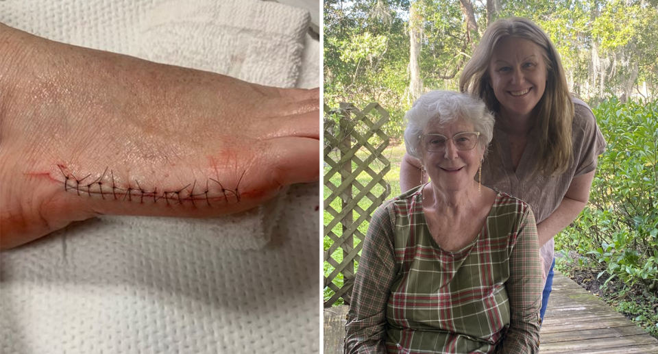 Leanne's foot was sliced open by the shoes. Smiling with her mother who originally purchased the boots. Source: Kennedy