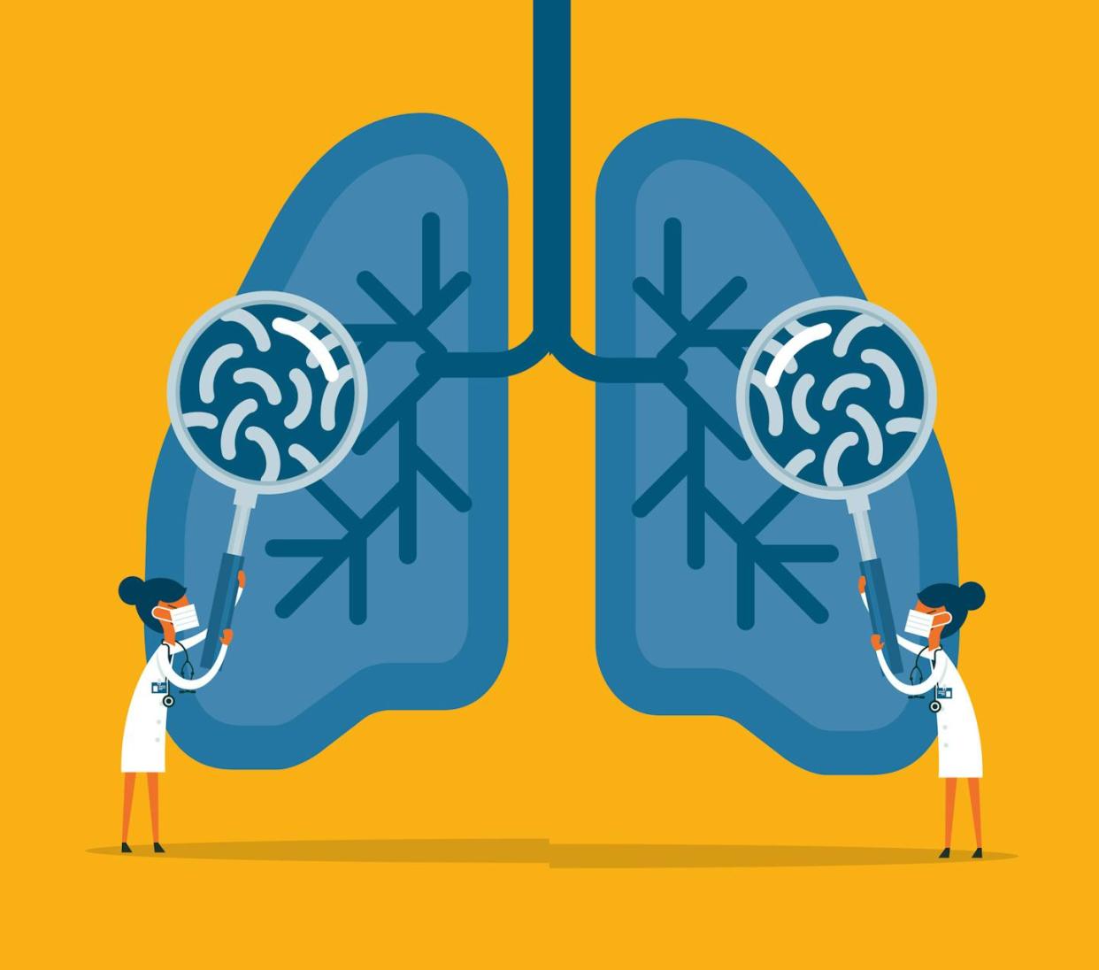 While the gut microbiome has gotten much of the spotlight, the microbes in the lungs also play an important role in health. <a href="https://www.gettyimages.com/detail/illustration/bacteria-and-viruses-on-human-lungs-royalty-free-illustration/1283819612" rel="nofollow noopener" target="_blank" data-ylk="slk:sorbetto/DigitalVision Vectors via Getty Images;elm:context_link;itc:0;sec:content-canvas" class="link ">sorbetto/DigitalVision Vectors via Getty Images</a>