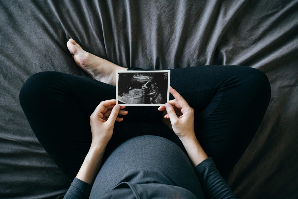 pregnant person holding an ultrasound