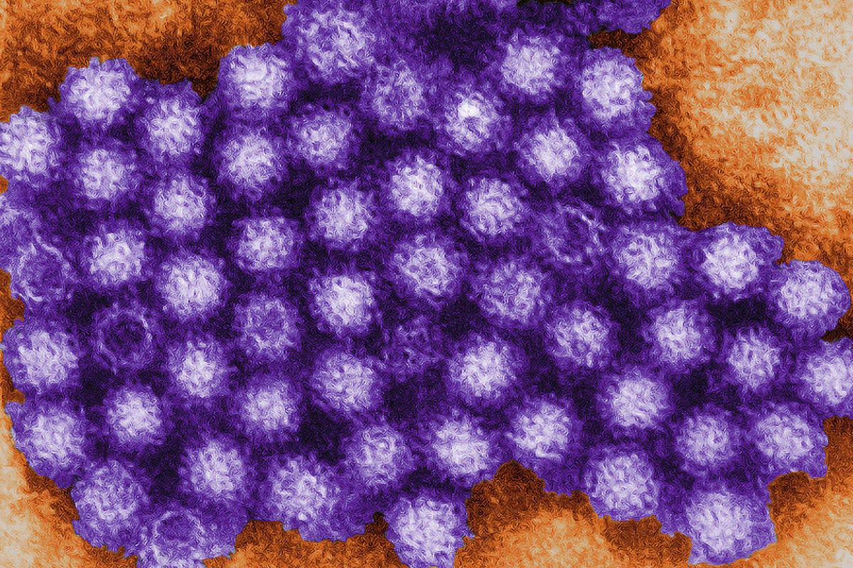 A micrograph of the norovirus, a bug that sickens millions every year (Charles D Humphrey / Centers for Disease Control and Prevention / PA Wire)