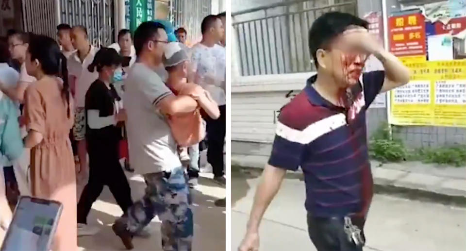 Man carries child, while another man seen with blood on his face. 