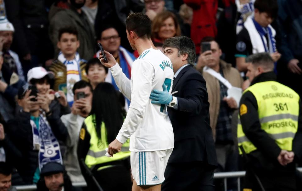 Cristiano Ronaldo used the camera on a mobile phone to check his appearance after sustaining a cut to the face. (Getty)