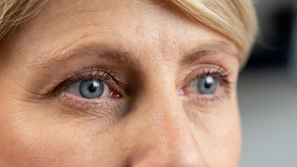 Dermatologists Reveal The Best Ways To Fix Droopy Eyelids Without Surgery 