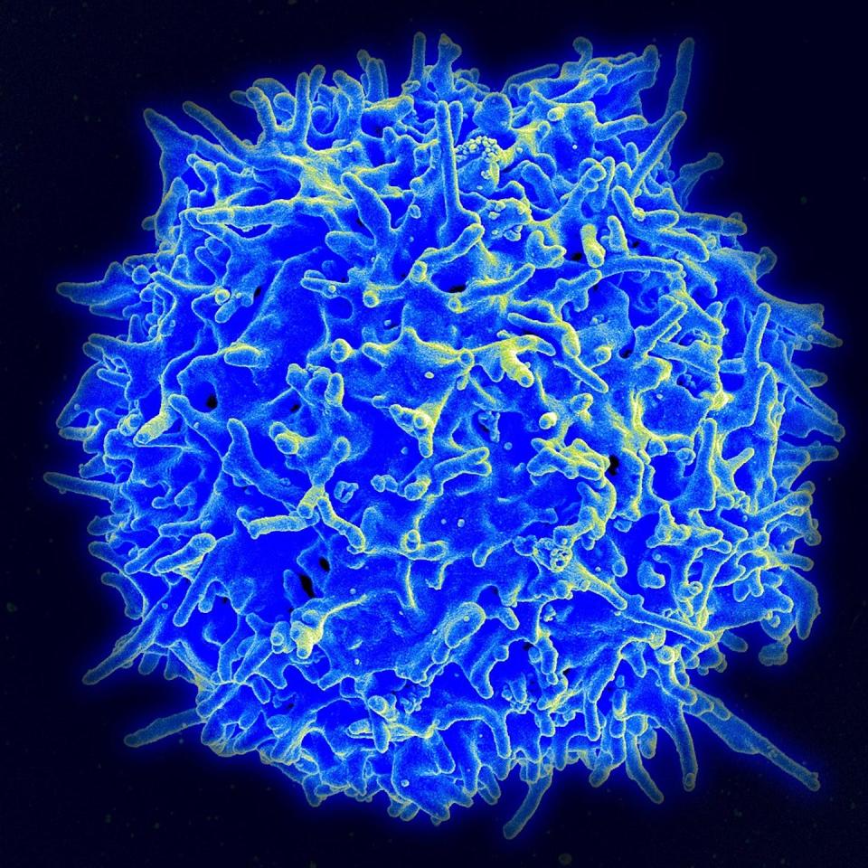 T cells play an important role in fighting against disease. <a href="https://www.nist.gov/image/healthyhumantcelljpg" rel="nofollow noopener" target="_blank" data-ylk="slk:National Institute of Allergy and Infectious Diseases;elm:context_link;itc:0" class="link rapid-noclick-resp">National Institute of Allergy and Infectious Diseases</a>