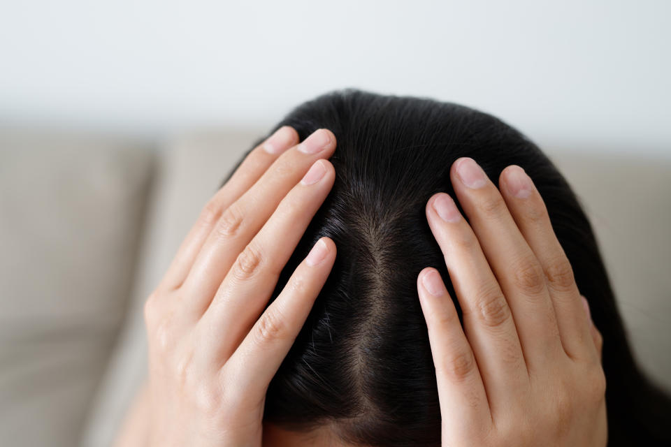 A woman has problems with hair and scalp,she has dandruff from allergic reactions to shampoos. and hair conditioner