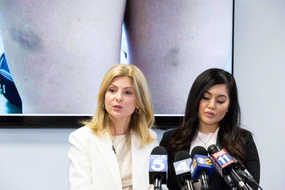 Andrea Buera (R), who is accusing singer Trey Songz of assaulting her, speaks during a press conference with her attorney Lisa Bloom (L) at The Bloom Firm on March 13, 2018 in Woodland Hills, California. Buera has already obtained a restraining order based on the alleged assault that took place February 18 in Hollywood (Getty)