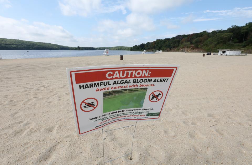 A sign warns about a a harmful algal bloom at Lake Welch in Harriman State Park Aug. 30, 2022. The lake has be closed since June..