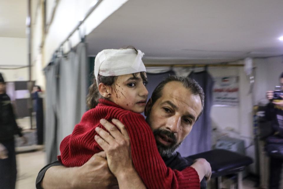 <p>A wounded Syrian girl is being taken to a hospital after Assad Regime carried out airstrikes to Zemalka town of besieged Eastern Ghouta, which is a de-escalation zone in Damascus, Syria on Feb. 7, 2018. (Photo: Khaled Akasha/Anadolu Agency/Getty Images) </p>