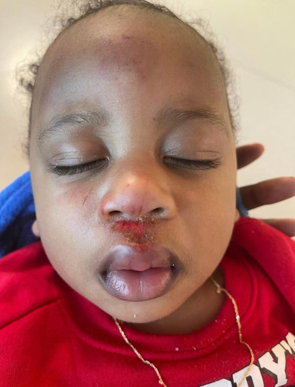 One-year-old Cylen was injured after the Pensacola Police Department's SWAT team raided the home of his father, Corey Marioneaux, on Feb. 3. The child fell headfirst out of the back of a stationary patrol vehicle.