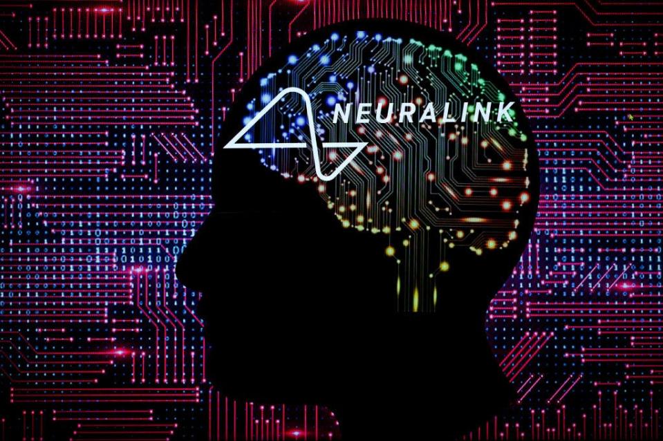 Neuralink setzte erstmals einen seiner Chips in einem Menschen ein, nach langjährigen Tests an Affen. - Copyright: Photo illustration by Jonathan Raa/NurPhoto via Getty Images