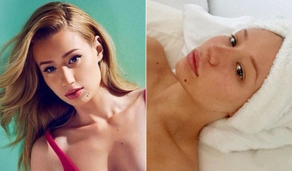 <p>Hätten wir ohne ihre markanten Schönheitsflecken kaum wiedererkannt: Rapperin Iggy Azalea zeigte auf Instagram ihre wahre Schönheit – zur großen Begeisterung ihrer knapp zehn Millionen Follower, die in ihren Kommentaren schwärmten, Iggy solle doch bitte öfter mal das Make-up weglassen! (Bilder: Instagram/thenewclassic)</p>