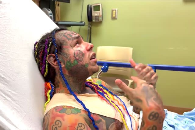 Tekashi 6ix9ine Tekashi 6ix9ine shows off his injuries from a march attack at a gym