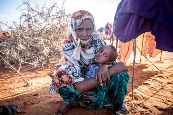 PHOTO: A woman and her family have been displaced due to drought conditions, migrating to Dollow, Somalia, in search for aid. Extreme drought has killed hundreds of thousands of livestock, and the rising costs of food prices has caused food insecurity. (SOPA Images/LightRocket via Getty Images, FILE)