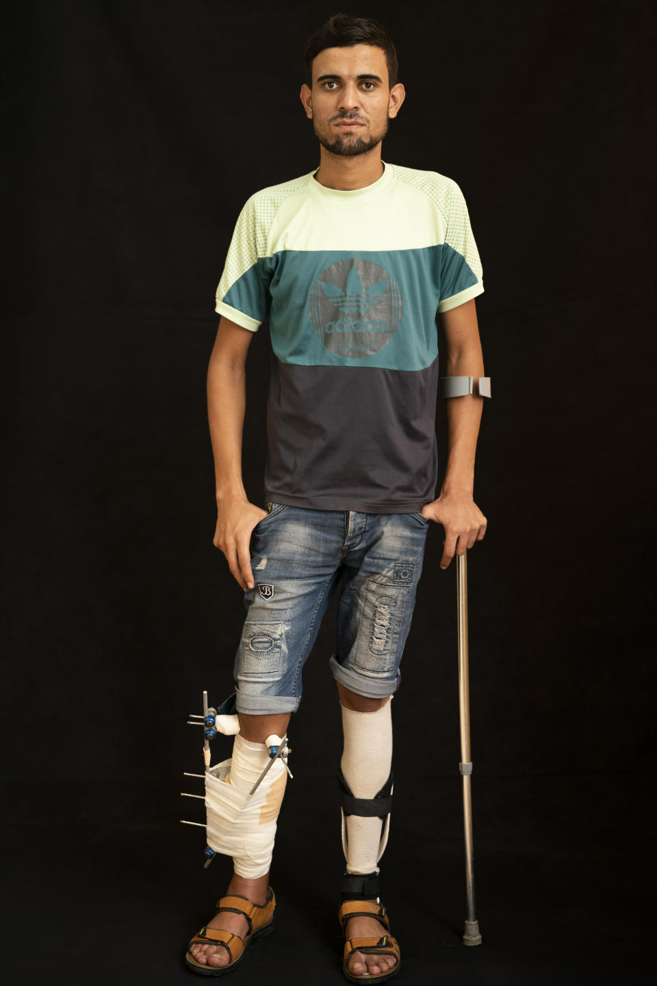 In this Sept. 19, 2018, photo, Mohammed al-Eissawi, 24, poses as he awaits treatment at a Gaza City clinic run by MSF (Doctors Without Borders). Al-Eissawi says he was throwing rocks with a slingshot when he was shot in the leg several times. He has been protesting for five years and has been injured many times. He says that he is not afraid and will continue to take part in protests. (AP Photo/Felipe Dana)