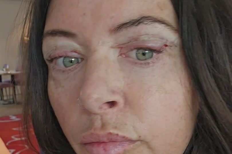 Gemma shortly after the surgery