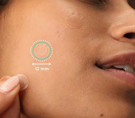 These patches will quickly conceal pesky spots