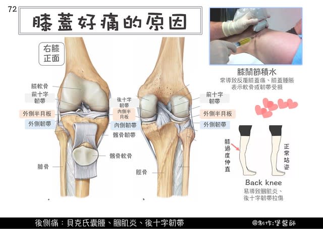 膝蓋痛怎麼辦