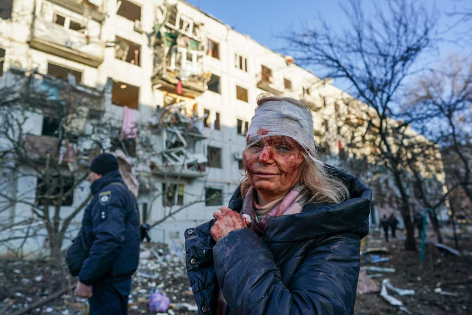 Les photos marquantes du conflit en Ukraine