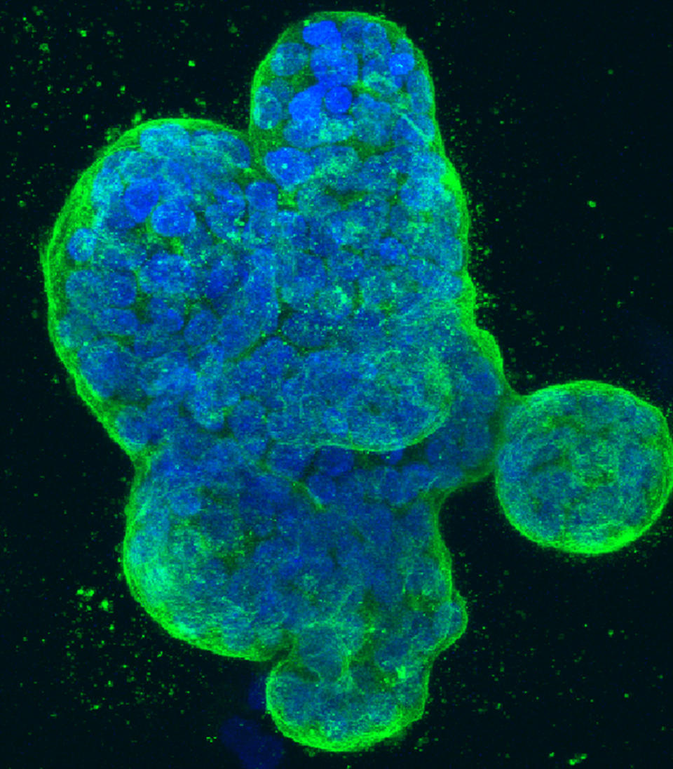 This photo provided by the National Institutes of Health shows a three-dimensional culture of human breast cancer cells, with DNA stained blue and a protein in the cell surface membrane stained green. Eight years ago, a team of researchers launched a project to carefully repeat influential lab experiments in cancer research. They recreated 50 experiments, the type of work with mice and test tubes that sets the stage for new cancer drugs. They reported the results Tuesday, Dec. 7, 2021: About half the scientific claims didn’t hold up. (National Institutes of Health via AP)