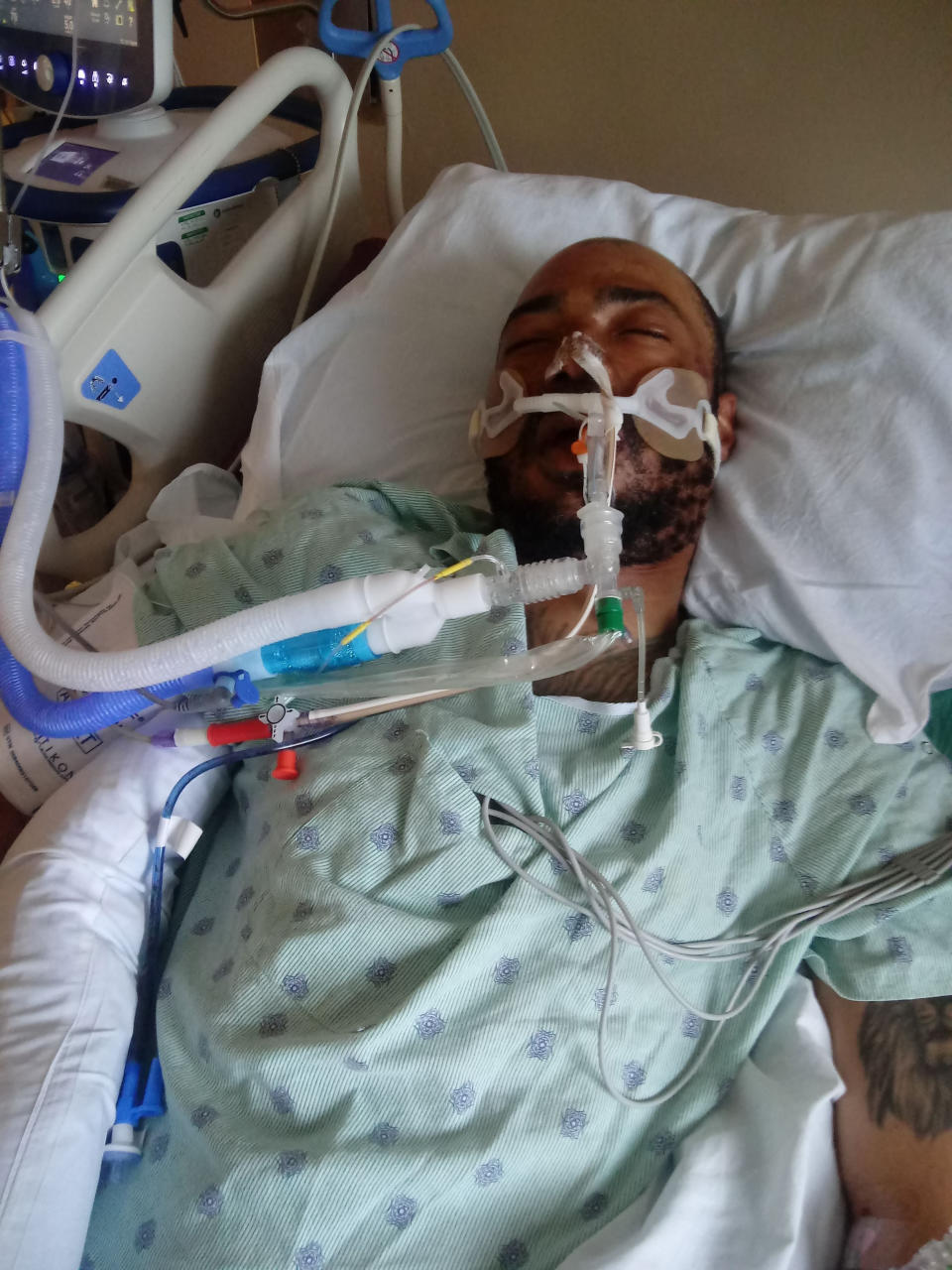 This photo provided by Rita Gowens shows her son, Demetrio Jackson, at the Sacred Heart Hospital in Eau Claire, Wis., in October 2021. Gowens spoke to him, held his hand and hoped for a miracle. She eventually agreed to remove him from a ventilator after his condition didn’t improve, singing into his ear as he took his final breaths: “You’ve never lost a battle, and I know, I know, you never will.” (Rita Gowens via AP)