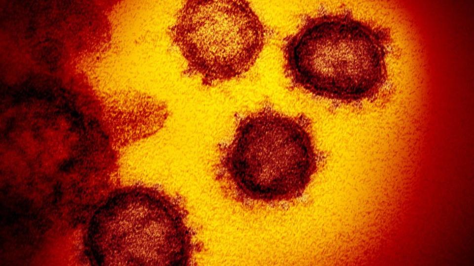 Coronavirus.