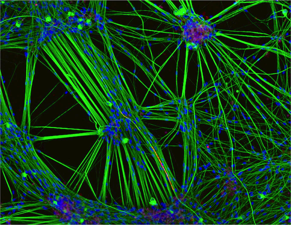 Culture of neurons (stained green) derived from human skin cells, and Schwann cells, a second type of brain cell (stained red). <cite>Rebecca Nutbrown</cite>