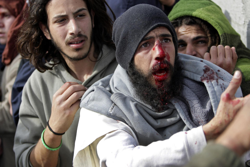 Injured Israeli settlers appeal to Palestinians not to hit them while they are detained by Palestinian villagers in a building under construction in the northern West Bank village of Qusra, Jan. 7, 2014. (AP Photo/Nasser Ishtayeh)