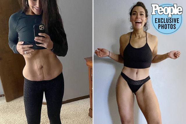 Erica Lugo 'Cried' at Photos of Herself Post-Tummy Tuck: 'I've