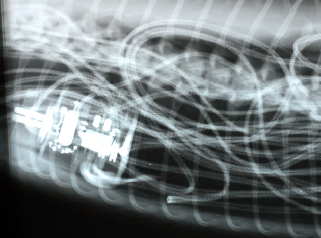 A pre-surgery X-ray of Houdini, a 12-foot (3.6-meter) Burmese python that swallowed an entire electric blanket _ with the electrical cord and control box, is shown in Ketchum, Idaho, Wednesday, July 19, 2006. It took surgery on Tuesday, July 18, 2006, to save the python after it swallowed the electric blanket _ with the electrical cord and control box. This X-ray shows some of the tangle of the blanket's wiring and mechanism in the python. (AP Photo/Dev Khalsa)