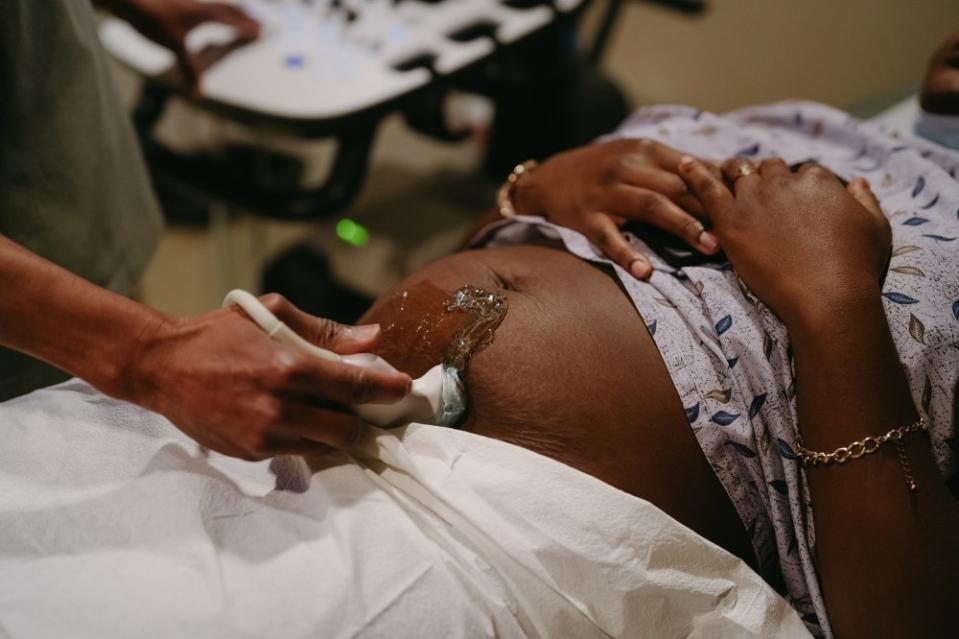 Dr. Balthrop performs an ultrasound on a patient who is 14 weeks pregnant.<span class="copyright">Lucy Garrett for TIME</span>